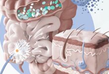 ارتباط روده و درخشش پوست