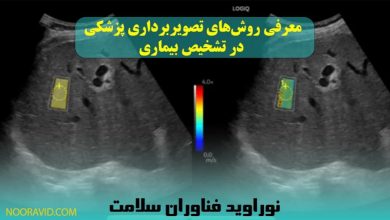 معرفی روشهای الاستوگرافی و مامو گرافی در کنار روشهای تصویربرداری پزشکی