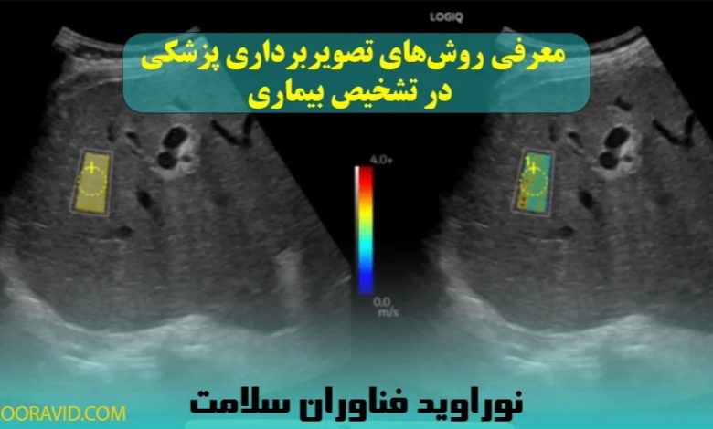 معرفی روشهای الاستوگرافی و مامو گرافی در کنار روشهای تصویربرداری پزشکی